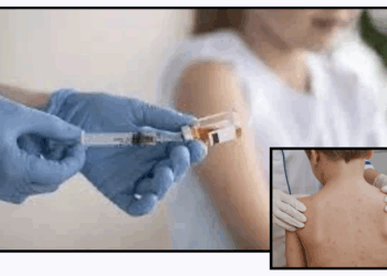 Refuerzan vigilancia por sarampión en Piedras Negras.