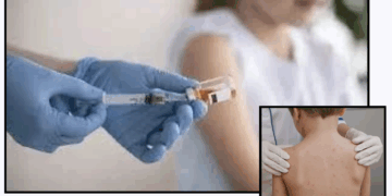 Refuerzan vigilancia por sarampión en Piedras Negras.