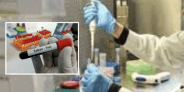 Autoridades de Del Río emiten alerta por rabia y dan recomendaciones.