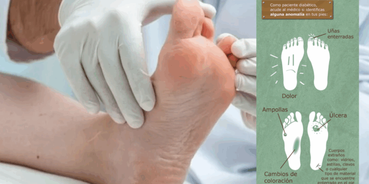 Registran más de 27 mil amputaciones al año por diabetes.